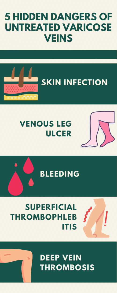 Scared to get your varicose veins treated? Read about the 5 dangers if you leave it untreated.

#VaricoseVeins

https://veinandendovascularsurgery.sg/varicose-veins/