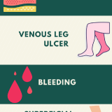 2.-5-Hidden-Dangers-of-Untreated-Varicose-Veins-2Cheng-sc-veins-april