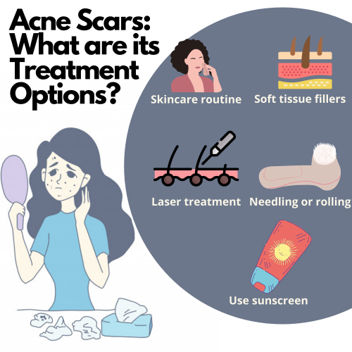 Can’t get rid of your acne scars? Read about how you can treat it with laser treatment for pigmentation available in Singapore!

#LaserTreatmentForPigmentationSingapore

https://www.drvalentin.com.sg/treatments/laser-skin-treatment-acne-scar-pore-removal/