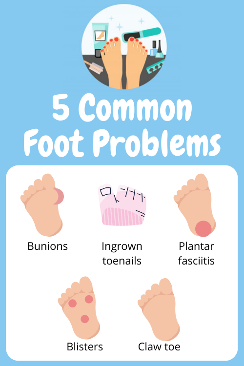 3.-5-Common-Foot-Problems-ECPC-march.png