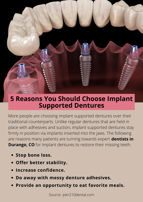 5-Reasons-You-Should-Choose-Implant-Supported-Dentures.png