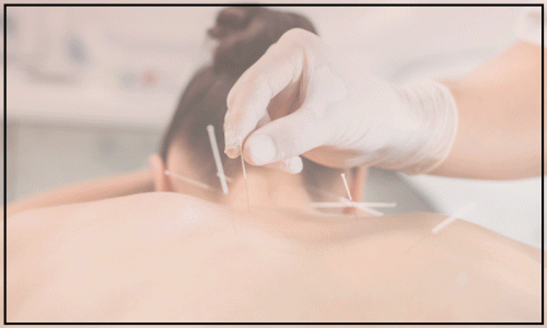 Acupuncture-Treatment-in-Toronto.gif