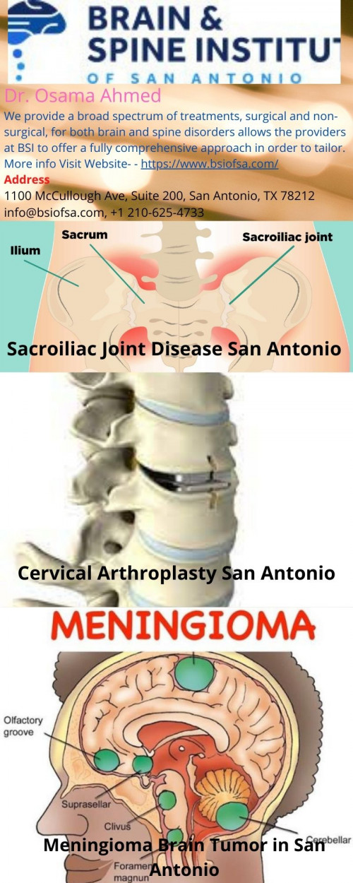 Our Brain and Spine Institute in San Antonio, Live Oak & Hondo is proud to offer a wide variety of treatment options to include some of the most up-to-date treatments for brain and spine disorders.

Please Visit Our Websites - https://bsiofsa.com/treatments/