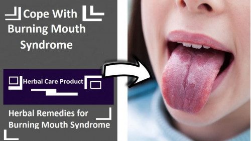 Some Herbal Treatment for Burning Mouth Syndrome that can help those that suffer from Burning Mouth to get some relief includes drinking small sips of water frequently. You can also suck on chips of ice or chew sugarless gum.
https://www.herbal-care-products.com/blog/how-to-cope-with-burning-mouth-syndrome-at-home/