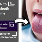 Burning-Mouth-Syndrome-1-1024x575