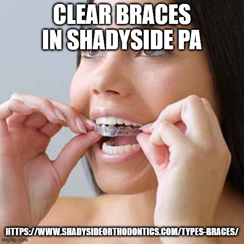 Clear-Braces-in-Shadyside-PA.jpg