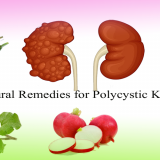 Easy-Natural-Remedies-for-Polycystic-Kidney-Disease-and-Diet-Plan-for-PKD