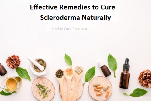 Effective-Remedies-to-Cure-Scleroderma-Naturally.png