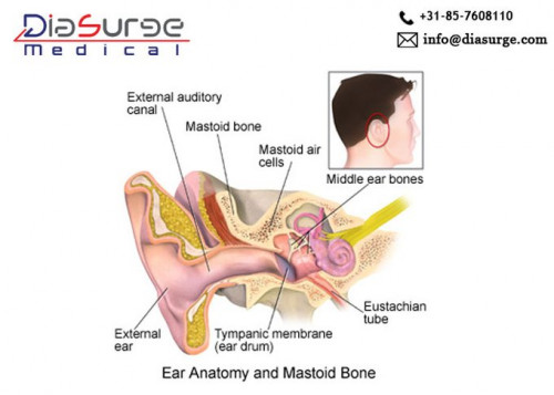 A mastoidectomy is a procedure performed to remove the mastoid air cells, When they get diseased & cause problems like deadness, vertigo, meningitis & more.
Instruments needed for surgery- endoscope, endoscope irrigation & suction system, video monitor.
https://bit.ly/2VCVg6a