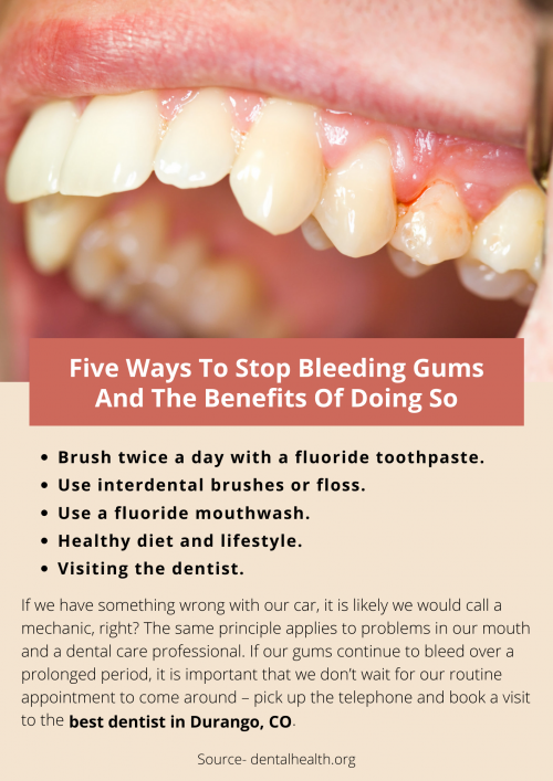 Five-Ways-To-Stop-Bleeding-Gums-And-The-Benefits-Of-Doing-So.png