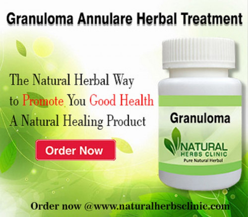 Granuloma annulare is very comparable the same to psoriasis in that together is incendiary immune system matter of the skin. We utilize the Natural Remedies for Granuloma Annulare and the skin detox method for Granuloma Annulare Natural Treatment... https://herbsnaturalclinic.weebly.com/blog/utilize-natural-remedies-to-abolish-granuloma-annulare-skin-disease