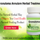 Granuloma-Annulare-Herbal-Treatment