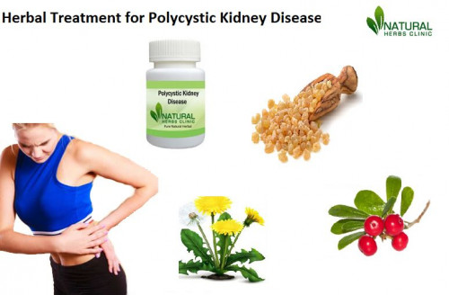 Dandelion is one of the most useful Herbal Treatment for Polycystic Kidney Disease has been confirmed to be extremely useful for PKD patients... https://www.wonderzine.com/talks/topics/32855-natural-remedies-for-polycystic-kidney-disease-suitable-way-to-treat