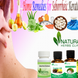 Natural-Home-Remedies-for-Seborrheic-Keratosis