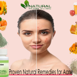 Natural-Remedies-for-Acne