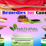 Natural-Remedies-for-Candidiasis