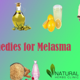 Natural-Remedies-for-Melasma