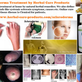 Natural-Treatment-for-Scleroderma