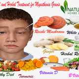 Natural-and-Herbal-Treatment-for-Myasthenia-Gravis