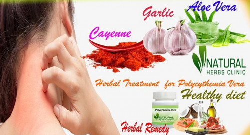 It is recommended to eat two to three raw garlic cloves in the morning on an empty stomach because it can help in the Herbal Treatment for Polycythemia Vera... https://www.naturalherbsclinic.com/blog/natural-and-herbal-treatment-for-polycythemia-vera/