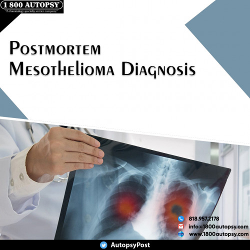 Postmortem-Mesothelioma-Diagnosis2.jpg