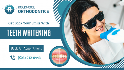 Restore the shine and confidence to your smile with professional teeth whitening services from a team of skilled orthodontists. Contact Rockwood Orthodontics at info@rockwoodsmiles.com for an appointment today.