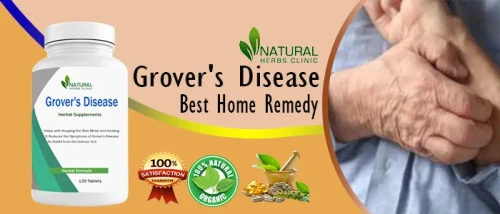 While home remedies, herbal therapies, and Natural Remedies For Grover's Disease can all provide relief from Grover's Disease symptoms, it's crucial to speak with a dermatologist before implementing any novel strategies. https://www.naturalherbsclinic.com/product/grovers-disease/