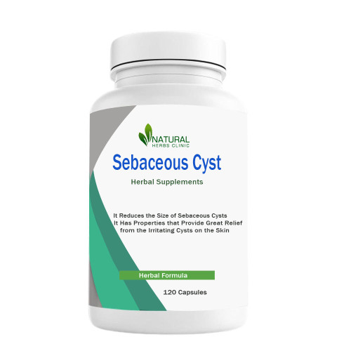 Herbal Supplement for Sebaceous Cyst composed entirely of natural herbs is available at Natural Herbs Clinic. It has been created especially for patients with sebaceous cysts. The growth might be slowed down with the use of this herbal treatment for sebaceous cysts. https://www.naturalherbsclinic.com/product/sebaceous-cyst/