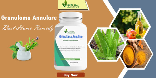 Get Granuloma Annulare Symptom Relief with these simple and effective strategies. Learn how to take control of your condition today and start feeling better. https://naturalherbsclinic.wixsite.com/naturalherbs/post/granuloma-annulare-symptom-relief-taking-control-on-simple-strategies