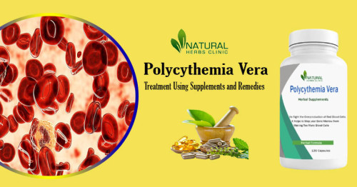 There is currently no cure for the condition. However, recent advances in understanding the disorder have led to many Polycythemia Vera Treatment Advancements that help manage condition. https://naturalherbsclinic.wixsite.com/naturalherbs/post/polycythemia-vera-treatment-advancements-exploring-the-latest-innovations