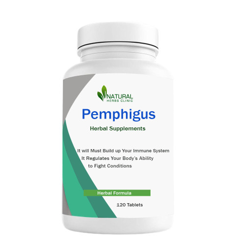 Herbal Treatment For Pemphigus