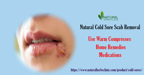 Struggling with a cold sore scab? Learn the best ways to quickly and safely Cold Sore Scab Removal without causing any further irritation. https://www.naturalherbsclinic.com/blog/natural-cold-sore-scab-removal-best-ways-to-manage-the-blisters/