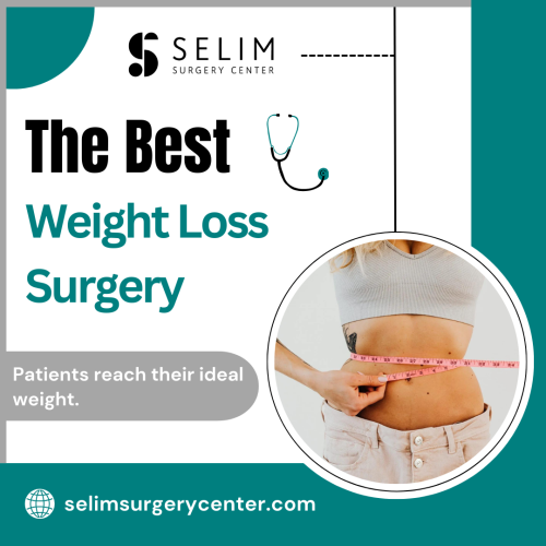 We provide support for patients, including lifetime nutrition counseling for both before and after surgery, with a team of registered dietitians. Our experts can help you find the right program to achieve your weight-loss goals. For more information, call us at (337) 502-8706.