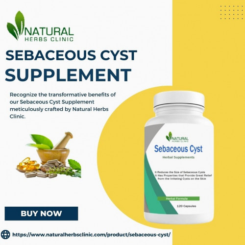 Acquire Information how to reduce sebaceous cyst scarring with simple home treatments. Locate the best methods to help minimize scarring and improve the appearance of your skin. https://www.articlebowl.com/minimizing-sebaceous-cyst-scarring-with-simple-home-treatments/
