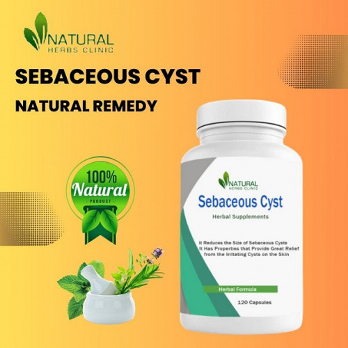 Gain Wisdom how to safely perform sebaceous cyst pus evacuation at home with these easy-to-follow steps. Find out what tools and techniques to use. https://www.articleshood.com/sebaceous-cyst-pus-evacuation-how-to-safely-perform-this-procedure-at-home/