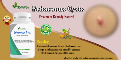 Educate oneself about the safe and effective Sebaceous Cyst Extraction procedures used to treat the problem. Find out what causes them, how they are treated, and how to prevent them from recurring in the future. https://www.linkedin.com/pulse/sebaceous-cysts-extraction-treating-safe-effective-procedures-sarah-pwnef/