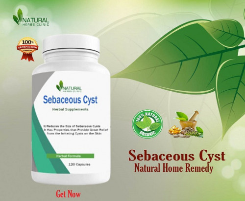 Absorb information how to properly care for your sebaceous cyst at home with these helpful Sebaceous Cyst Care Tips. Find out what steps you can take to reduce irritation, swelling, and other symptoms associated with sebaceous cysts. https://telegra.ph/The-Most-Effective-Sebaceous-Cyst-Care-Tips-to-Treat-the-Condition-11-02