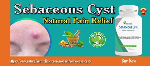 Are you suffering from the pain of an infected sebaceous cyst? Here are some simple Infected Sebaceous Cyst Pain Relief tips to help reduce your discomfort and get back to living life free of pain. Find out what works best for you and start feeling better today. https://www.newyorktimesnow.com/infected-sebaceous-cyst-pain-relief-easy-tips-to-help-get-rid-of-the-discomfort/