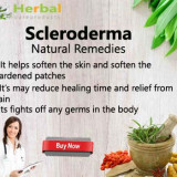 Scleroderma