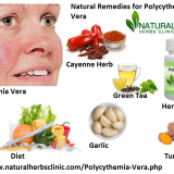 Try-These-Natural-Herbal-Remedies-for-the-Proper-Herbal-Treatment-for-Polycythemia-Vera