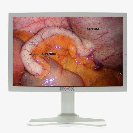 endoscopy-surgical-monitor-3-454x454.jpg